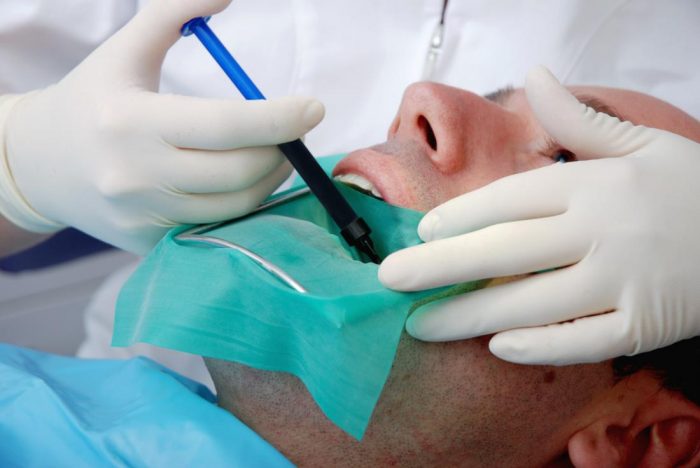 Root Canal Therapy Procedure