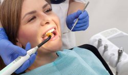 What Are The Benefits Of Teeth Cleaning?