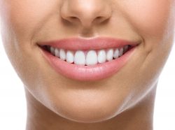 How Much Does Veneers Cost?