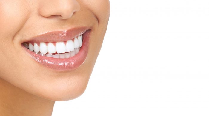 how much do veneers cost?