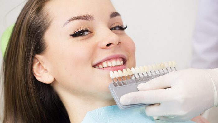 Dental Crowns in North Miami