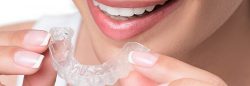 Affordable Dental Braces In Miami, FL