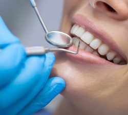 How to Choose the Best Dentist Office Near Me?