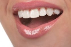 What Causes Swollen Gums? | How To Get Rid Of Swollen Gums?