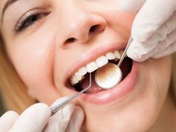 What Are The Advantages Of Deep Cleaning Teeth?