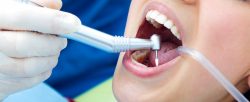 Root Canal Treatment Near Me