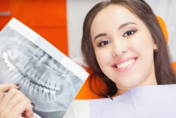 How Long Is the Dental Implant Surgery Recovery?