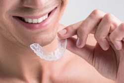 Invisible Orthodontic Braces In Miami Fl