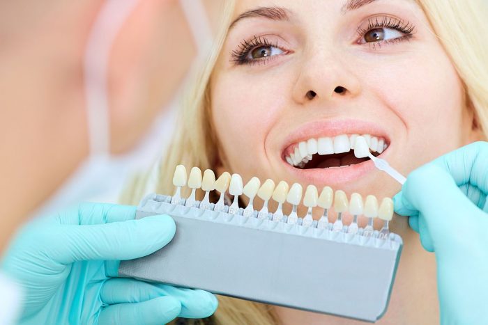 What Are The Benefits of Porcelain Veneers Near Me?