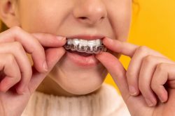 How to Find an Invisalign Dentist Near Me?