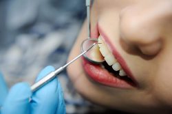 Dental Filling Procedure And Cost
