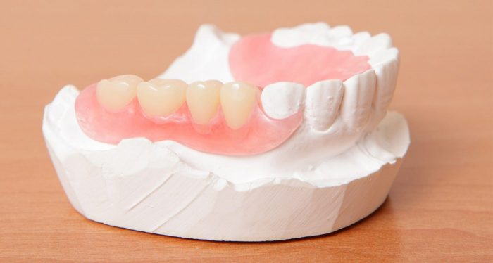 Affordable Full & Partial Dentures Near Me