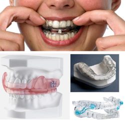 Sleep Apnea Oral Appliance Near Me