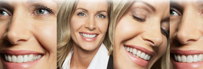 Same Day Dentures Before And After Process