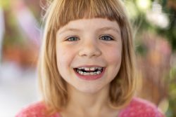 What Are The Benefits Of Orthodontics?