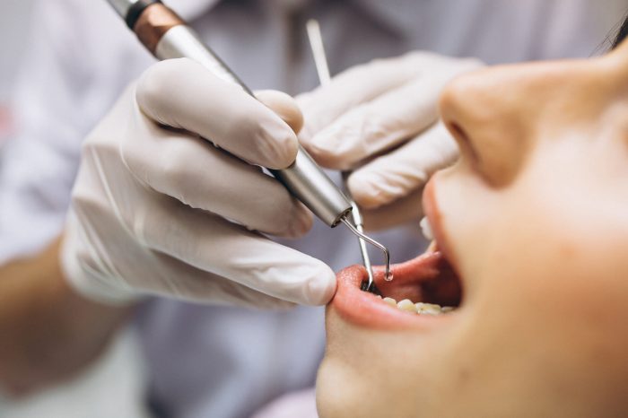 How can a walk in dental clinic help me?