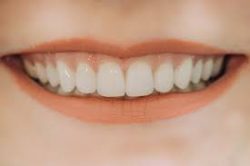 Dental Veneers Near Me | Cosmetic Dentistry Clinic – Veneers Dentist Houston