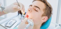 root canal treatment in Sunny Isles Beach