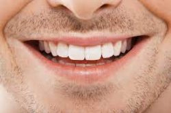 Gum Regeneration Treatments