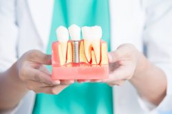 Emergency Dental Implants Near Me