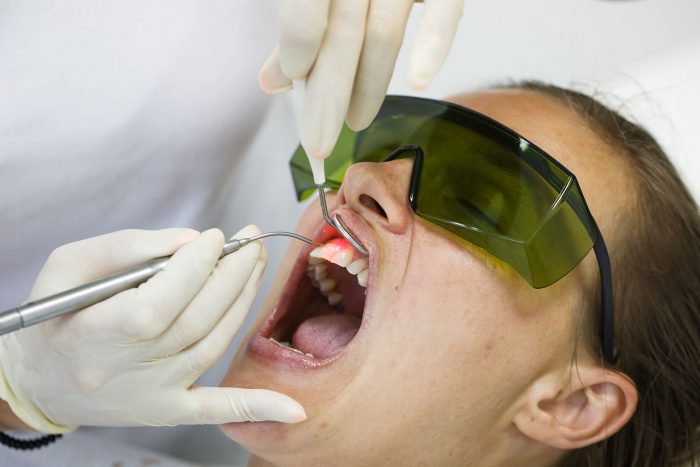 LANAP periodontal surgery Near Me