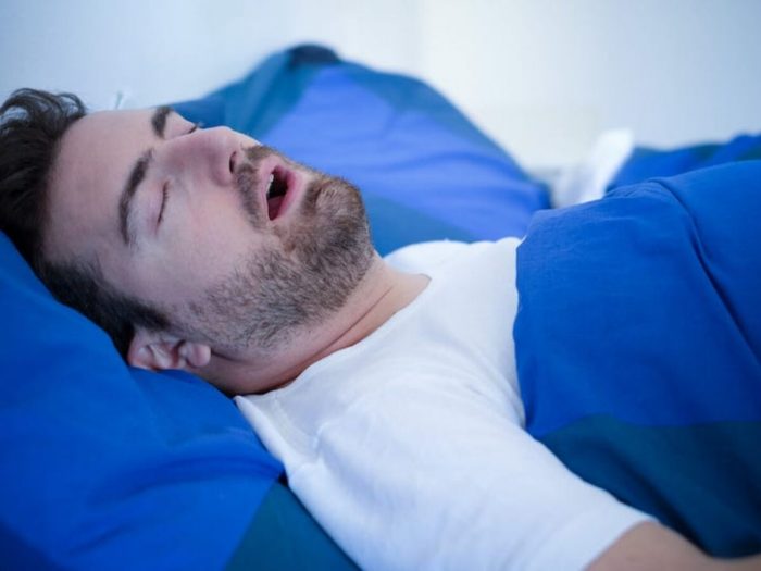 How Much Does Sleep Apnea Treatment Cost?