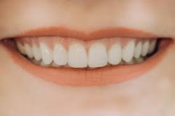The Best Houston Dentists for Cosmetic Dentistry