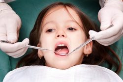 General Dentistry For Kids Miami Fl |Pediatric Dentistry in Miami