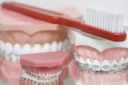 Orthodontist Near Me Open On Saturday Near Me – orthodontistbrace