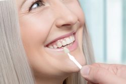 Dental Bridges in Aventura