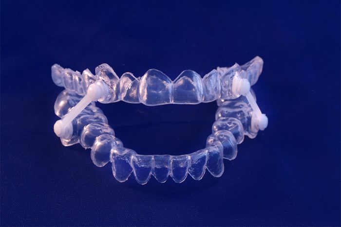 Mouth Devices for Sleep Apnea