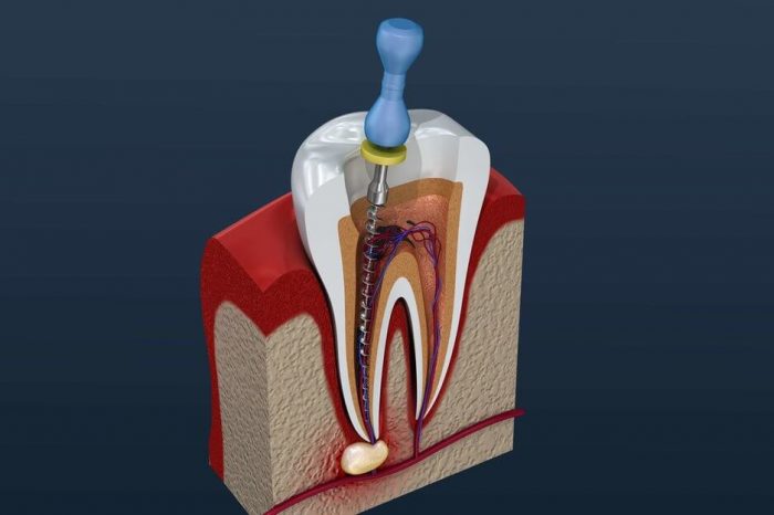 Saturday Dentists | Ideal Dental