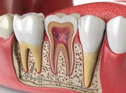 Houston TX : Root Canal Specialist Near Me