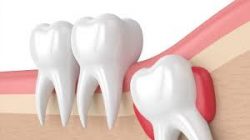Emergency Dental Center: Emergency Dentist Houston | 24 Hr Dentist | Emergency Dental Center