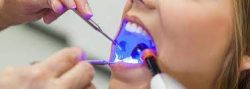 LANAP Dentist Near Me | LANAP Treatment Houston TX – Edge Dental