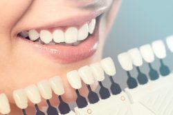 Best Cosmetic Dental Implants