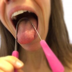 Tongue Scrapers, Tongue Cleaners, and Tongue Brushes – What’s the Difference?