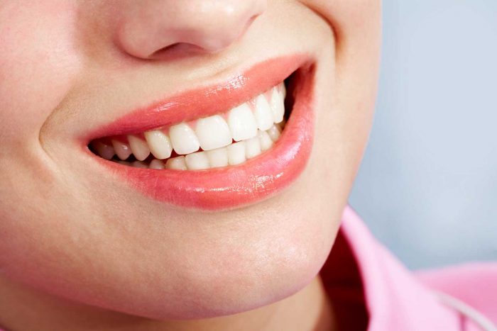 Zoom Teeth Whitening Houston TX