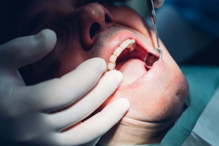 Emergency Tooth Extraction Near Me in Manhattan NYC