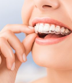 Invisalign Treatment Near Me |How Much Does Invisalign Cost Without Insurance?
