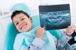 White Composite Filling – VIP Pediatric Dentist
