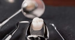 Wisdom Tooth Pain: Relief, Treatment, and More
