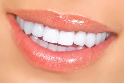 Laser Teeth Whitening – Find Laser Teeth Whitening