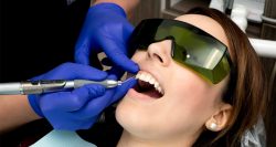 Gingivectomy Dentist In Houston