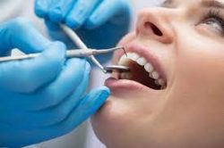 Emergency Dental Procedures: When Is a Tooth Extraction Needed?