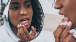 Wisdom Tooth Extractions – Houston, TX |Wisdom Teeth Removal in Houston, TX