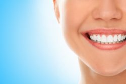 What are the Benefits of Teeth Bonding?