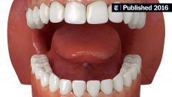 Benefits of Deep Cleaning Teeth | Regular Dental Cleaning