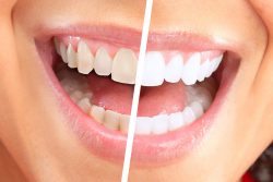 Family And Cosmetic Dentistry Service In Houston |Dentist in Houston, Texas – Family & ...