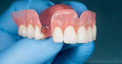 Dental Health and Dentures – Full and Partial Dentures Near Me